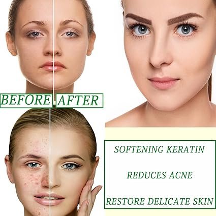 • ماسك الوجه بالشاي الأخضر - الصورة 5