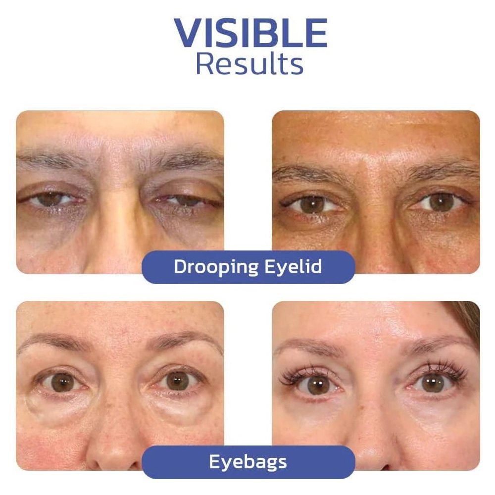 • 2 قطعة من كريم التخلص من تجاعيد منطقة العين - الصورة 3