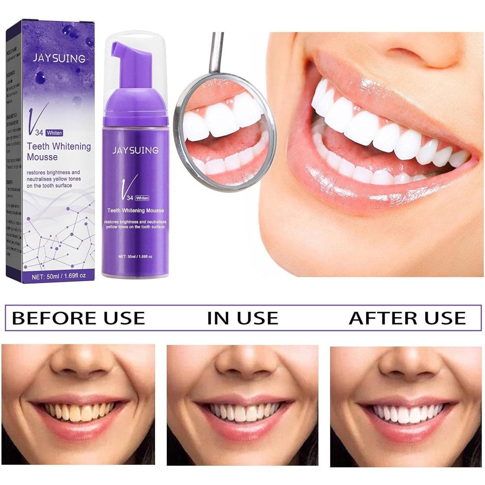 عرض 2 Whitening Foam Toothpaste